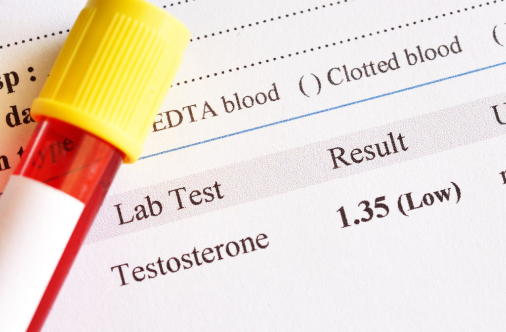 A laboratory test result shows a low testosterone level from an elderly person.